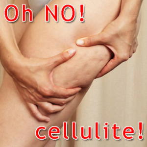 cellulite